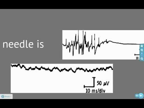 EMG and Action Potentials