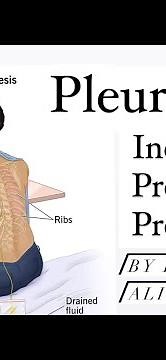 Thoracentesis/Pleural Tap by Dr Farhan Ali