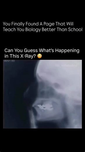 Biology | Medical on Instagram: "This unusual X-ray shows something you’re not expecting. Look carefully. #XRayMystery #GuessTheXRay #DoYouSeeIt #HiddenInside #waitforit #viral #explore #science #biology #bio #medical #viralreels"
