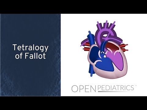 Tetralogy of Fallot by M. Mazwi | OPENPediatrics