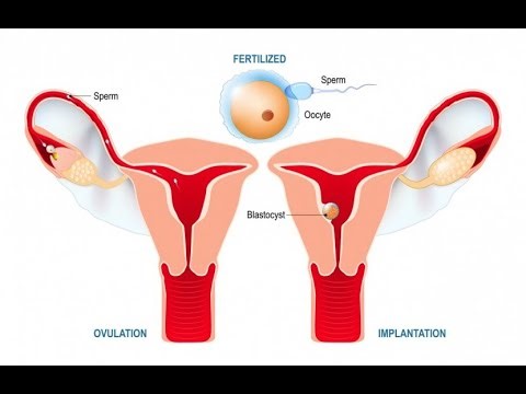 The Crucial Role of Embryo Implantation (3 Minutes)