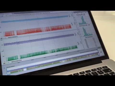 OpenSignals (r)evolution Overview - BITalino