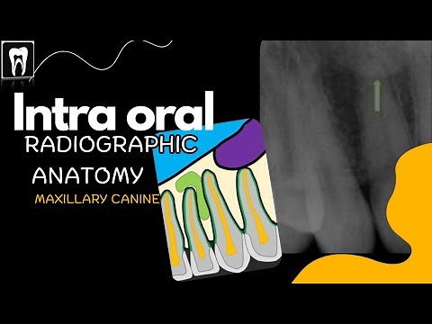 Normal radiographic anatomical landmarks | Intra Oral Anatomy | Maxilla Canine