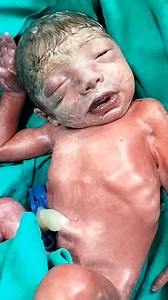 Preterm birth baby 🐥 | Mahak Chaudhary