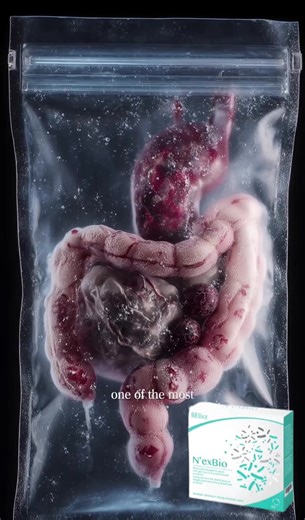 Ramai ingat stomach (perut) cuma berfungsi untuk cerna makanan. Sebenarnya, perut buat lebih daripada itu 👇 Stomach plays a bigger role in our gut health • Mengawal keseimbangan asid & bakteria • Menyediakan persekitaran supaya nutrien diserap dengan baik • Menyokong sistem pencernaan & keselesaan perut Bila perut & gut tak seimbang, mula lah rasa 👉 kembung 👉 tak selesa 👉 digestion jadi tak smooth N’exBio menyokong kesihatan gut secara menyeluruh Dengan gabungan prebiotik probiotik postbioti