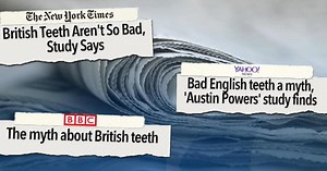 British teeth not as bad as often portrayed, study finds