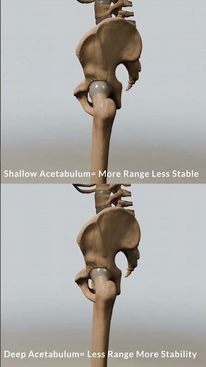 Understanding Hip Mobility: Shallow vs. Deep Acetabulum