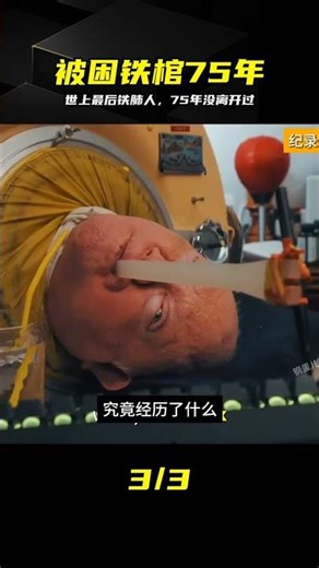 Trapped in a metal coffin for 75 years, the life of the world's only person with an iron lung #Ir...