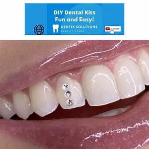 Swarovski Tooth Gem DIY Kit, Professional Grade Bonding System Used by Dentists - Etsy