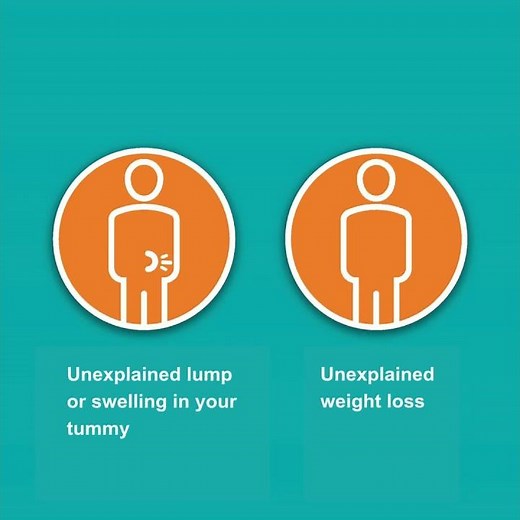 Early signs and symptoms of bowel cancer