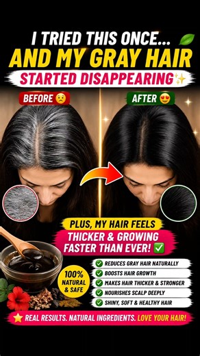 How to Reverse Gray Hair & Grow 2X Faster Naturally! #shorts #haircare #grayhair #hairgrowth
