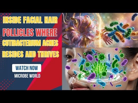 Inside Facial Hair Follicles Where Cutibacterium acnes Resides and Thrives 🌍