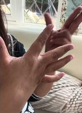 Sinus Colds Congestion Allergy Hayfever Relief - Hand Reflexology fingers sweep