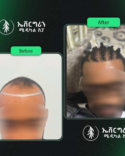 evergreen medical spa 📍አድራሻ: ወሎ ሰፈር ከቲኬ ህንፃ ጀርባ#foy #abesha #fouryou #ethiopian_tik_tok🇪🇹🇪🇹🇪🇹🇪🇹