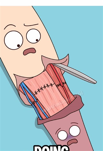 Is it even possible for a severed arm to be reattached? | reattaching arm