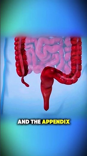 Appendix Removal Surgery Explained (3D Animation)#3danimation #medicalanimation #educationalcontent
