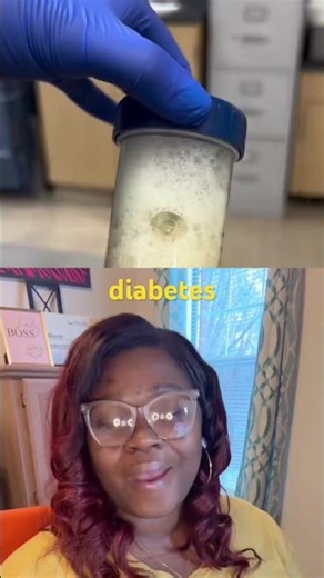 BUN and Creatinine are kidney enzymes. If these enzymes are elevated, a kidney disease have occurred