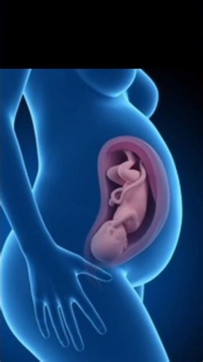 Percutaneous Umblicle Cord Blood Sampling (PUBS) Procedure #Short