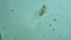 Micro Organism Infusorium Microscope Magnification 10x Stock Footage Video (100% Royalty-free) 1095193369 | Shutterstock