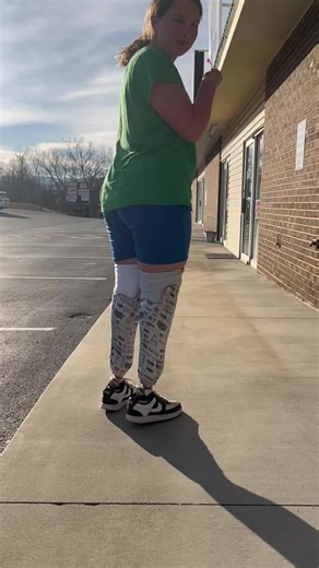 Custom Lamination for Bilateral Symes Prostheses