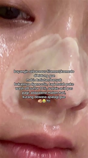 Banyangin sebaceous filament/komedo ga dipencet2 tapi pake sulfur, adapalene & azelaic acid! #skincaretips #acne #jerawat #komedo #komedohidung