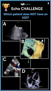 24K views · 122 reactions | There are many findings that point to an...