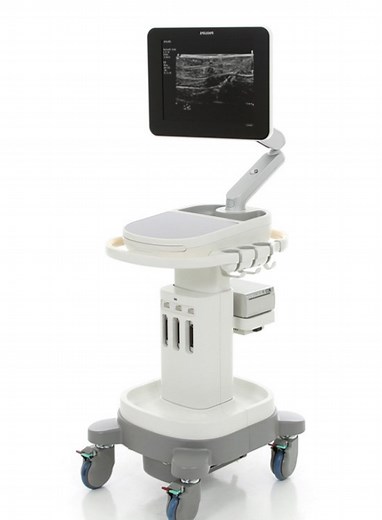 Philips Sparq Ultrasound System