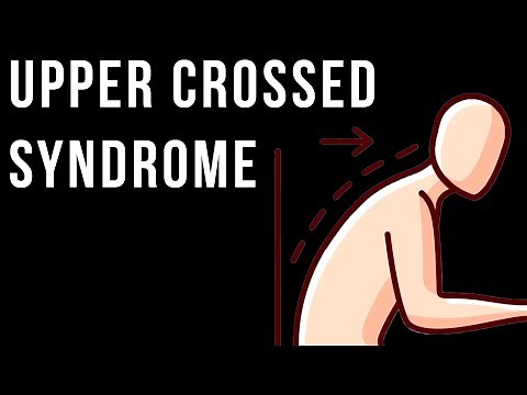 Fix Upper Crossed Syndrome: Best Exercises & Techniques for Posture Correction (Free Preview)
