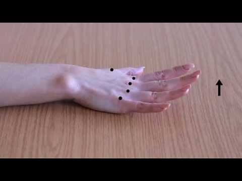 Active finger extension