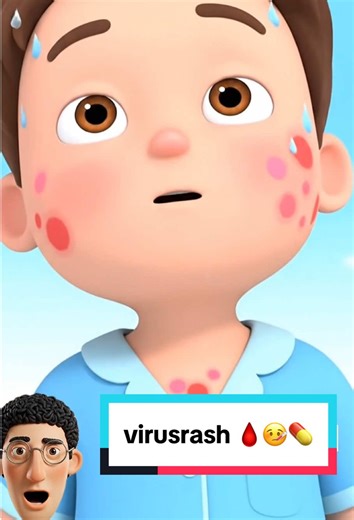 What happens inside the body when you have a viral rash with fever? 🤒🦠 #virusrash #health #healthscience #wellnessnesthub