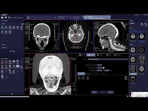 View&Go(Ranges) Parallel-Radial-Curved-Spine-Vascular Ranges