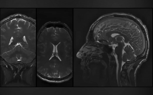 人类大脑活体实时成像