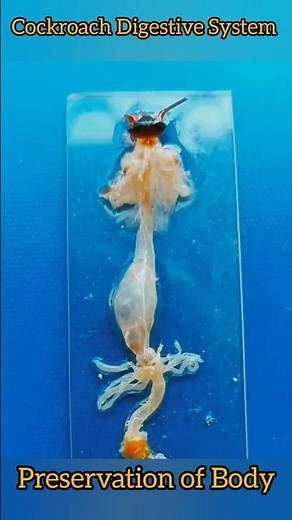 Cockroach Digestive System #anatomy #cockroach #preservation #slideshow #lab #zoology #biology