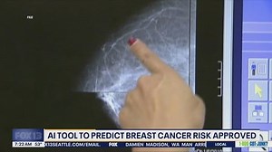 AI tool to predict breast cancer risk approved by FDA | Haystack News