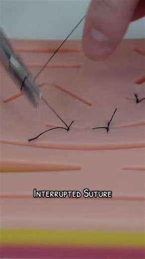 continues and interrupted stitches made simple #suturing #habitsthatchangeyourlife