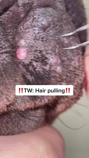 Effective Ways to Deal with Clogged Hair Follicles in Dogs