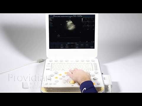 Philips CX50 Training Part 5: Doppler Modes