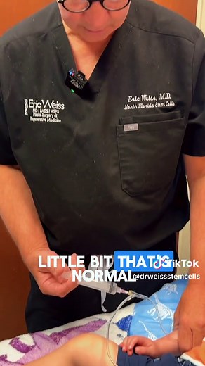 Understanding Stem Cell Administration: A Step-by-Step Guide