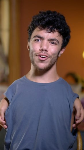 My limb difference made me go viral 🌟 #fbreels #borndifferent #thrombocytopeniaabsentradius #limbdifference | Born Different