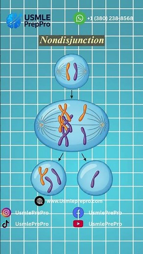 Down Syndrome: Meiotic Nondisjunction vs. Robertsonian Translocation