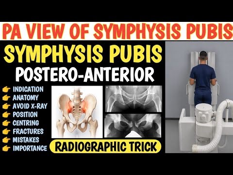 Symphysis Pubis X-ray Postero-Anterior View Explained! Step-by-Step PA View of Pubic Symphysis X-ray