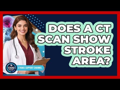Does A CT Scan Show Stroke Area?
