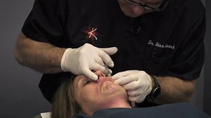 Adding Lip Volume and Smoothing Lines with Volbella