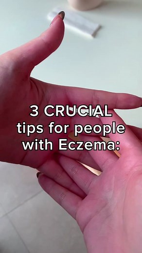 Top 3 Essential Tips for Eczema Relief