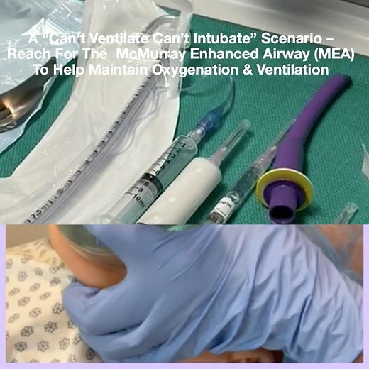 When a "can't ventilate can't intubate" scenario occurs #airwaymanagement #hospital