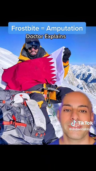 Severe Frostbite and Amputation: A Medical Case Study