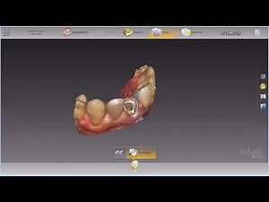 Cerec Guide Tutorial (EN) 🇺🇸