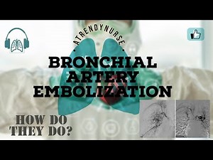 What Is Bronchial Artery Embolization ? How They Are Doing It?