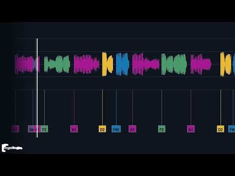 The Zombies - She s Not There - NO BASS