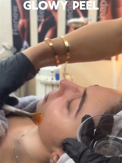 Flash Glowy Treatment Powered by Alpha Hydroxy Acids (AHAs): • Gently exfoliates & removes dead skin cells • Stimulates collagen & hyaluronic acid production • Helps reduce wrinkles & fine lines • Minimizes the appearance of pores Experience radiant, smoother, youthful-looking skin — with instant glow results ✨ 💫By Darine 📲 Book your appointment by WhatsApp: 03 03 23 56 📍Achrafieh, Facing AUST #DeeSpa #Lebanon #explore #peeling